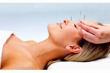 Tratamente naturale : Acupunctura